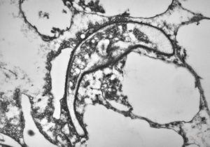 M,3m. | Pneumocystis carinii M,3m. | Pneumocystis carinii